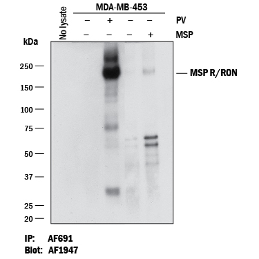 Human Phospho-MSP R/Ron (Y1238/Y1239) was immunoprecipitated from 1 mg of lysates of MDA-MB-453 human breast cancer cell line untreated (-) or treated (+) with 100 uM Pervanadate (PV) for 10 minutes or 100 ng/mL Recombinant Human MSP/MST1 Protein (Catalog # 352-MS) for 10 minutes. MSP R/Ron (Y1238/Y1239) was immunoprecipiated with 1 ug Goat Anti-Human MSP R/Ron Antigen Affinity-purified Polyclonal Antibody(Catalog # AF691). The MSP R/Ron (Y1238/Y1239)-antibody complexes were absorbed using Protein G Sepharose. Immunoprecipitated MSP R/Ron (Y1238/Y1239) was detected by Western blot using 0.1 µg/mL of Rabbit Anti-Human Phospho-MSP R/Ron (Y1238/Y1239) Antigen Affinity-purified Polyclonal Antibody (Catalog # AF1947).