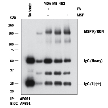 <b>Biological Strategies Validation. </b>Human MSP R/Ron was immunoprecipitated from 1 mg of lysates of MDA-MB-468 human breast cancer cell line untreated (-) or treated (+) with 100 uM Pervanadate (PV) for 10 minutes or 100 ng/mL Recombinant Human MSP/MST1 Protein (Catalog # 352-MS) for 10 minutes. MSP R/Ron was immunoprecipiated with 1 ug Goat Anti-Human MSP R/Ron Antigen Affinity-purified Polyclonal Antibody (Catalog # AF691). The MSP R/Ron-antibody complexes were absorbed using Protein G Sepharose. Immunoprecipitated MSP R/Ron was detected by Western blot using 0.2 µg/mL of Goat Anti-Human MSP R/Ron Antigen Affinity-purified Polyclonal Antibody (Catalog # AF691).