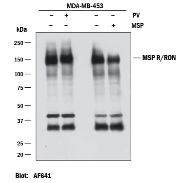 Western blot shows lysates of MDA-MB-468 human breast cancer cell line untreated (-) or treated (+) with 100 uM Pervanadate (PV) for 10 minutes or 100 ng/mL Recombinant Human MSP/MST1 Protein (Catalog # 352-MS) for 10 minutes. PVDF membrane was probed with 0.2 µg/mL of Goat Anti-Human MSP R/Ron Antigen Affinity-purified Polyclonal Antibody (Catalog # AF691) followed by HRP-conjugated Anti-Goat IgG Secondary Antibody (Catalog # HAF017). A specific band was detected for MSP R/Ron at approximately 150-160 kDa (as indicated). This experiment was conducted under reducing conditions and using Immunoblot Buffer Group 1.