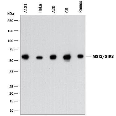 Western Blot MST2/STK3 Antibody (2072A) [Unconjugated]