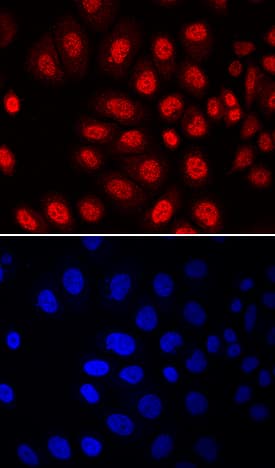 MSX2 was detected in immersion fixed SK-BR-3 human breast cancer cell line using Mouse Anti-Human MSX2 Monoclonal Antibody (Catalog # MAB7917) at 10 µg/mL for 3 hours at room temperature. Cells were stained using the NorthernLights™ 557-conjugated Anti-Mouse IgG Secondary Antibody (red, upper panel; Catalog # NL007) and counterstained with DAPI (blue, lower panel). Specific staining was localized to nuclei. View our protocol for Fluorescent ICC Staining of Cells on Coverslips.