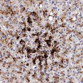MT2A was detected in immersion fixed paraffin-embedded sections of human liver using Mouse Anti-Human MT2A Monoclonal Antibody (Catalog # MAB10176) at 5 µg/mL for 1 hour at room temperature followed by incubation with the Anti-Mouse IgG VisUCyte™ HRP Polymer Antibody (Catalog # VC001). Before incubation with the primary antibody, tissue was subjected to heat-induced epitope retrieval using Antigen Retrieval Reagent-Basic (Catalog # CTS013). Tissue was stained using DAB (brown) and counterstained with hematoxylin (blue). Specific staining was localized to cytoplasm in hepatocytes. View our protocol for IHC Staining with VisUCyte HRP Polymer Detection Reagents.