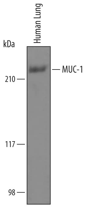 Western blot shows lysates of human lung tissue. PVDF Membrane was probed with 1 µg/mL of Sheep Anti-Human MUC-1 Antigen Affinity-purified Polyclonal Antibody (Catalog # AF6298) followed by HRP-conjugated Anti-Sheep IgG Secondary Antibody (Catalog # HAF016). A specific band was detected for MUC-1 at approximately 230 kDa (as indicated). This experiment was conducted under reducing conditions and using Immunoblot Buffer Group 1.