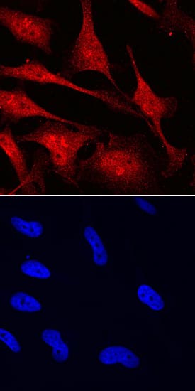 MYCL1/L-Myc was detected in immersion fixed HeLa human cervical epithelial carcinoma cell line using Goat Anti-Human/Mouse MYCL1/L-Myc Antigen Affinity-purified Polyclonal Antibody (Catalog # AF4050) at 10 µg/mL for 3 hours at room temperature. Cells were stained using the NorthernLights™ 557-conjugated Anti-Goat IgG Secondary Antibody (red, upper panel; Catalog # NL001) and counterstained with DAPI (blue, blue panel). Specific staining was localized to cytoplasm and nuclei. View our protocol for Fluorescent ICC Staining of Cells on Coverslips.