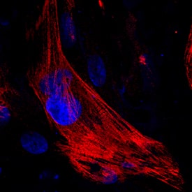 Immunocytochemistry MYH6 Antibody (940344) [Unconjugated]