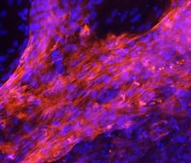 Immunocytochemistry MYH7 Antibody (2021A) [Unconjugated]