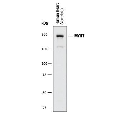 Western Blot MYH7 Antibody (2021A) [Unconjugated]