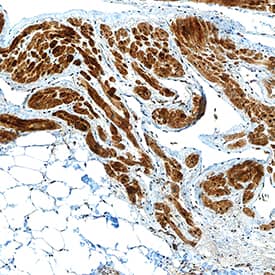 Immunohistochemistry MYH7 Antibody (940906) [Unconjugated]