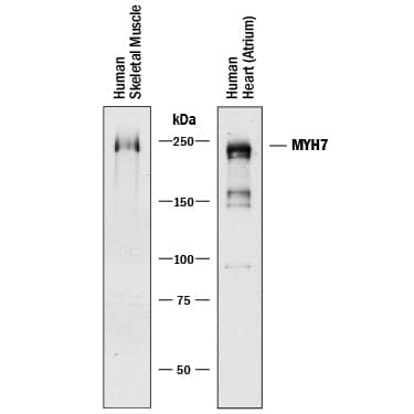 Western Blot MYH7 Antibody (940906) [Unconjugated]