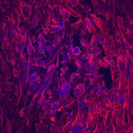 Matrilin-1 was detected in immersion fixed human mesenchymal stem cells differentiated into chondrocytes using Mouse Anti-Human Matrilin-1 Monoclonal Antibody (Catalog # MAB7878) at 10 µg/mL for 3 hours at room temperature. Cells were stained using the NorthernLights™ 557-conjugated Anti-Mouse IgG Secondary Antibody (red; Catalog # NL007) and counterstained with DAPI (blue). Specific staining was localized to cartilage matrix. View our protocol for Fluorescent ICC Staining of Cells on Coverslips.
