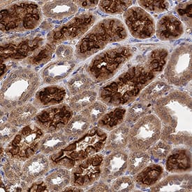 Megalin/LRP2 was detected in immersion fixed paraffin-embedded sections of human kidney using Mouse Anti-Human Megalin/LRP2 Monoclonal Antibody (Catalog # MAB9578) at 5 µg/mL for 1 hour at room temperature followed by incubation with the Anti-Mouse IgG VisUCyte™ HRP Polymer Antibody (Catalog # VC001). Tissue was stained using DAB (brown) and counterstained with hematoxylin (blue). Specific staining was localized to convoluted tubules. View our protocol for IHC Staining with VisUCyte HRP Polymer Detection Reagents.
