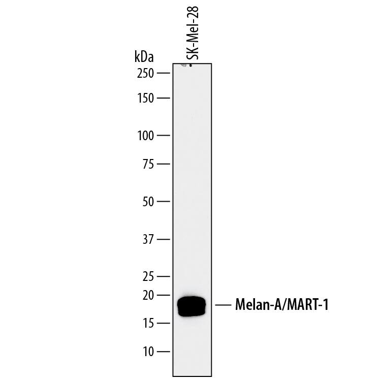 Western blot shows lysates of SK-Mel-28 human malignant melanoma cell line. PVDF membrane was probed with 0.5 µg/mL of Sheep Anti-Human Melan-A/ MART-1 Antigen Affinity-purified Polyclonal Antibody (Catalog # AF8008) followed by HRP-conjugated Anti-Sheep IgG Secondary Antibody (Catalog # HAF016). A specific band was detected for Melan-A/MART-1 at approximately 18-20 kDa (as indicated). This experiment was conducted under reducing conditions and using Immunoblot Buffer Group 1.