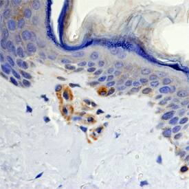 Melan-A/MART-1 was detected in immersion fixed paraffin-embedded sections of human skin using Mouse Anti-Human Melan-A/MART-1 Monoclonal Antibody (Catalog # MAB8008) at 15 µg/mL overnight at 4 °C. Before incubation with the primary antibody, tissue was subjected to heat-induced epitope retrieval using Antigen Retrieval Reagent-Basic (Catalog # CTS013). Tissue was stained using the Anti-Mouse HRP-DAB Cell & Tissue Staining Kit (brown; Catalog # CTS002) and counterstained with hematoxylin (blue). Specific staining was localized to melanocytes. View our protocol for Chromogenic IHC Staining of Paraffin-embedded Tissue Sections.
