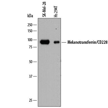 Western blot shows lysates of SK-Mel-28 human malignant melanoma cell line and Hs 294T human melanoma cell line. PVDF membrane was probed with 1 µg/mL of Mouse Anti-Human Melanotransferrin/CD228 Monoclonal Antibody (Catalog # MAB8175) followed by HRP-conjugated Anti-Mouse IgG Secondary Antibody (Catalog # HAF018). A specific band was detected for Melanotransferrin/CD228 at approximately 90-95 kDa (as indicated). This experiment was conducted under reducing conditions and using Immunoblot Buffer Group 1.
