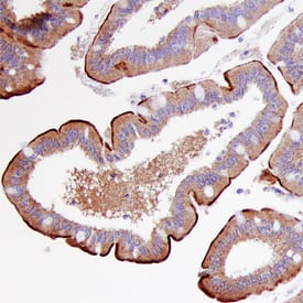 Meprin  beta  Subunit/MEP1B was detected in immersion fixed paraffin-embedded sections of human intestine using Human/Mouse Meprin  beta  Subunit/MEP1B Monoclonal Antibody (Catalog # MAB28951) at 1 µg/mL overnight at 4 °C. Before incubation with the primary antibody, tissue was subjected to heat-induced epitope retrieval using Antigen Retrieval Reagent-Basic (Catalog # CTS013). Tissue was stained using the Anti-Rat HRP-DAB Cell & Tissue Staining Kit (brown; Catalog # CTS017) and counterstained with hemotoxylin (blue). Specific staining was localized to the Brush border of epithelial cells. View our protocol for Chromogenic IHC Staining of Paraffin-embedded Tissue Sections. This application has not been tested in mouse samples