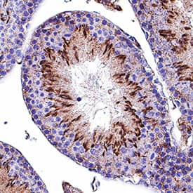 Mer was detected in perfusion fixed frozen sections of mouse testis using Goat Anti-Mouse Mer Antigen Affinity-purified Polyclonal Antibody (Catalog # AF591) at 1 µg/mL for 1 hour at room temperature followed by incubation with the Anti-Goat IgG VisUCyte™ HRP Polymer Antibody (Catalog # VC004). Tissue was stained using DAB (brown) and counterstained with hematoxylin (blue). Specific staining was localized to sperm cells. View our protocol for IHC Staining with VisUCyte HRP Polymer Detection Reagents.