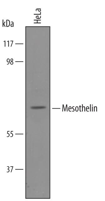 Western blot shows lysates of HeLa human cervical epithelial carcinoma cell line. PVDF membrane was probed with 1 µg/mL of Human Mesothelin Antigen Affinity-purified Polyclonal Antibody (Catalog # AF3265) followed by HRP-conjugated Anti-Goat IgG Secondary Antibody (Catalog # HAF019). A specific band was detected for Mesothelin at approximately 69 kDa (as indicated). This experiment was conducted under reducing conditions and Immunoblot Buffer Group 8.