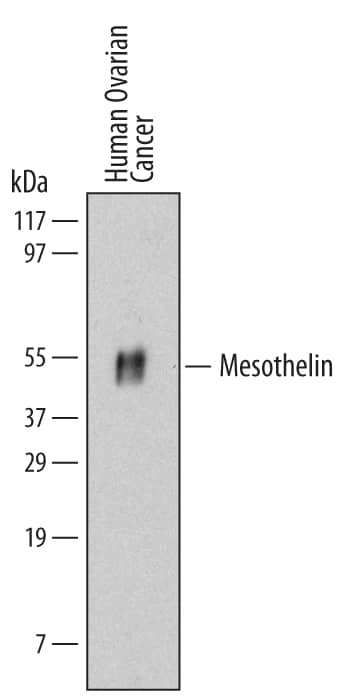Western blot shows lysates of human ovarian cancer tissue. PVDF Membrane was probed with 2 µg/mL of Human Mesothelin Monoclonal Antibody (Catalog # MAB32653) followed by HRP-conjugated Anti-Mouse IgG Secondary Antibody (Catalog # HAF007). A specific band was detected for Mesothelin at approximately 50 kDa (as indicated). This experiment was conducted under reducing conditions and using Immunoblot Buffer Group 1.