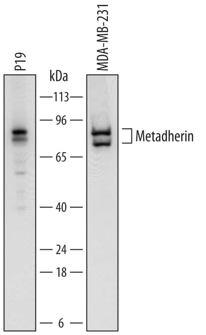 Western blot shows lysates of P19 mouse embryonal carcinoma cell line and MDA-MB-231 human breast cancer cell line. PVDF membrane was probed with 0.25 µg/mL of Sheep Anti-Human/Mouse Metadherin Antigen Affinity-purified Polyclonal Antibody (Catalog # AF7180) followed by HRP-conjugated Anti-Sheep IgG Secondary Antibody (Catalog # HAF016). Specific bands were detected for Metadherin at approximately 80 and 75 kDa (as indicated). This experiment was conducted under reducing conditions and using Immunoblot Buffer Group 1.