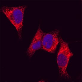 Metadherin was detected in immersion fixed HeLa human cervical epithelial carcinoma cell line using Sheep Anti-Human Metadherin Antigen Affinity-purified Polyclonal Antibody (Catalog # AF7644) at 5 µg/mL for 3 hours at room temperature. Cells were stained using the NorthernLights™ 557-conjugated Anti-Sheep IgG Secondary Antibody (red; Catalog # NL010) and counterstained with DAPI (blue). Specific staining was localized to cytoplasm. View our protocol for Fluorescent ICC Staining of Cells on Coverslips.