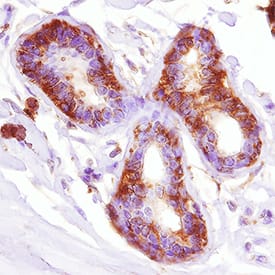 Metadherin was detected in immersion fixed paraffin-embedded sections of human breast using Sheep Anti-Human Metadherin Antigen Affinity-purified Polyclonal Antibody (Catalog # AF7644) at 3 µg/mL overnight at 4 °C. Tissue was stained using the Anti-Sheep HRP-DAB Cell & Tissue Staining Kit (brown; Catalog # CTS019) and counterstained with hematoxylin (blue). Specific staining was localized to cytoplasm and nuclei. View our protocol for Chromogenic IHC Staining of Paraffin-embedded Tissue Sections.