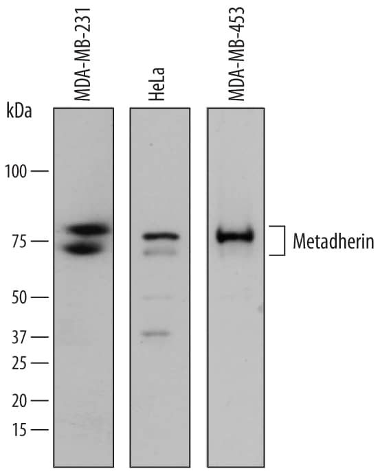 Western blot shows lysates of MDA-MB-231 human breast cancer cell line, HeLa human cervical epithelial carcinoma cell line, and MDA-MB-453 human breast cancer cell line. PVDF membrane was probed with 0.2 µg/mL of Sheep Anti-Human Metadherin Antigen Affinity-purified Polyclonal Antibody (Catalog # AF7644) followed by HRP-conjugated Anti-Sheep IgG Secondary Antibody (Catalog # HAF016). Specific bands were detected for Metadherin at approximately 80 and 75 kDa (as indicated). This experiment was conducted under reducing conditions and using Immunoblot Buffer Group 1.