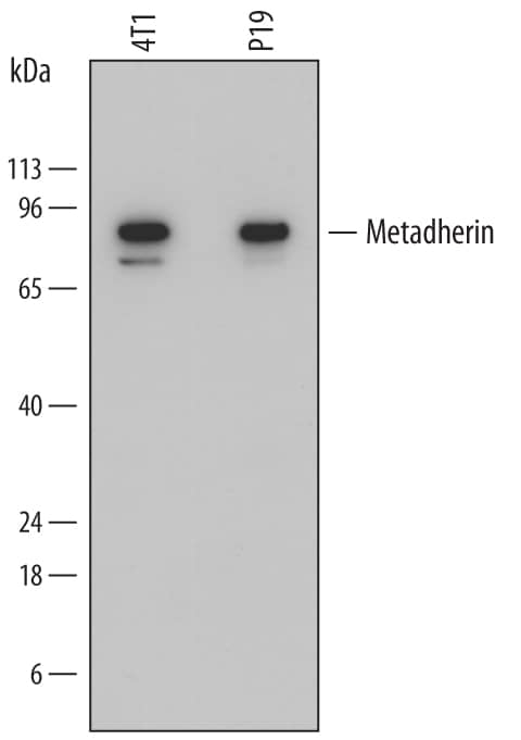 Western blot shows lysates of 4T1 mouse breast cancer cell line and P19 mouse embryonal carcinoma cell line. PVDF membrane was probed with 1 µg/mL of Rat Anti-Mouse Metadherin Monoclonal Antibody (Catalog # MAB7180) followed by HRP-conjugated Anti-Rat IgG Secondary Antibody (Catalog # HAF005). A specific band was detected for Metadherin at approximately 80 kDa (as indicated). This experiment was conducted under reducing conditions and using Immunoblot Buffer Group 1.