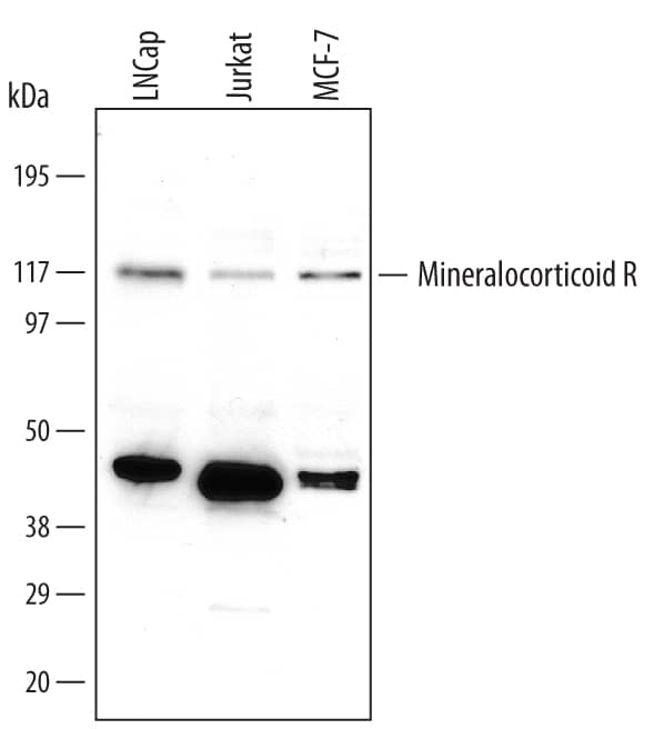 Western blot shows lysates of LNCaP human prostate cancer cell line, Jurkat human acute T cell leukemia cell line, and MCF-7 human breast cancer cell line. PVDF membrane was probed with 1 µg/mL of Human Mineralocorticoid R/NR3C2 Monoclonal Antibody (Catalog # MAB4369) followed by HRP-conjugated Anti-Mouse IgG Secondary Antibody (Catalog # HAF007). A specific band was detected for Mineralocorticoid R/NR3C2 at approximately 110 kDa (as indicated). This experiment was conducted under reducing conditions and using Immunoblot Buffer Group 3.