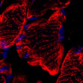 Mitofusin 2 was detected in perfusion fixed frozen sections of mouse skeletal muscle using Sheep Anti-Human/Mouse/Rat Mitofusin 2 Antigen Affinity-purified Polyclonal Antibody (Catalog # AF7884) at 1.7 µg/mL overnight at 4 °C. Tissue was stained using the NorthernLights™ 557-conjugated Anti-Sheep IgG Secondary Antibody (red; Catalog # NL010) and counterstained with DAPI (blue). Specific staining was localized to cytoplasm. View our protocol for Fluorescent IHC Staining of Frozen Tissue Sections.