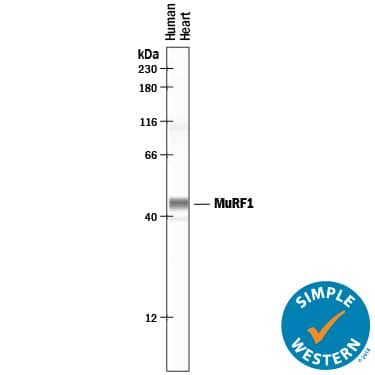 Simple Western MuRF1/TRIM63 Antibody [Unconjugated]