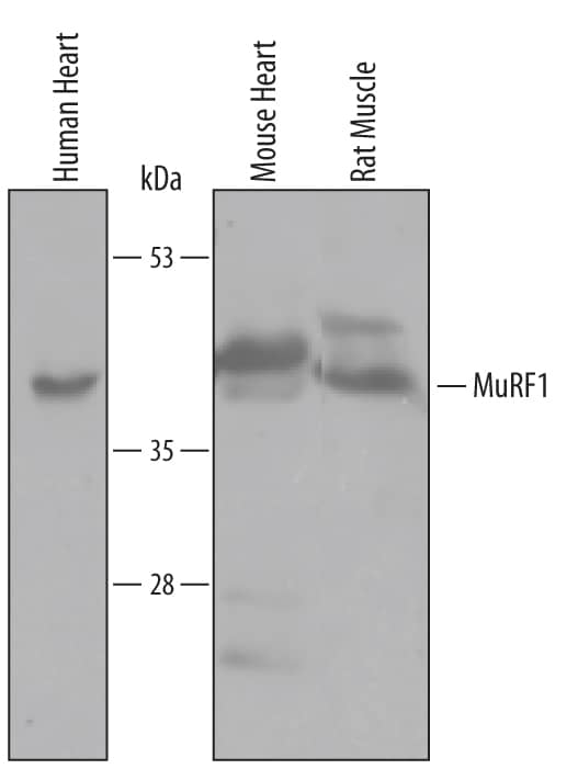 Western blot shows lysates of human heart, mouse heart, and rat muscle tissue. PVDF membrane was probed with 1 µg/mL of Goat Anti-Human/Mouse/Rat MuRF1 Antigen Affinity-purified Polyclonal Antibody (Catalog # AF5366) followed by HRP-conjugated Anti-Goat IgG Secondary Antibody (Catalog # HAF019). A specific band was detected for MuRF1 at approximately 41-44 kDa (as indicated). This experiment was conducted under reducing conditions and using Immunoblot Buffer Group 8.