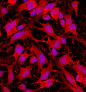 Musashi-2 was detected in immersion fixed undifferentiated rat cortical stem cells using Goat Anti-Human Musashi-2 Antigen Affinity-purified Polyclonal Antibody (Catalog # AF3255) at 10 µg/mL for 3 hours at room temperature. Cells were stained using the NorthernLights™ 557-conjugated Anti-Goat IgG Secondary Antibody (red; Catalog # NL001) and counter-stained with DAPI (blue). Specific staining was localized to cytoplasm. View our protocol for Fluorescent ICC Staining of Cells on Coverslips.
