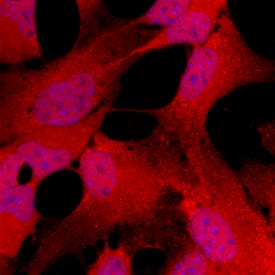 Immunocytochemistry Musashi-1 Antibody [Unconjugated]
