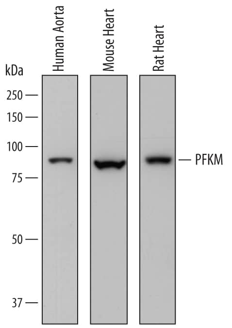 Western blot shows lysates of human aorta tissue, mouse heart tissue, and rat heart tissue. PVDF membrane was probed with 0.5 µg/mL of Sheep Anti-Human/Mouse/Rat Muscle Phosphofructokinase/PFKM Antigen Affinity-purified Polyclonal Antibody (Catalog # AF7687) followed by HRP-conjugated Anti-Sheep IgG Secondary Antibody (Catalog # HAF016). A specific band was detected for Muscle Phosphofructokinase/PFKM at approximately 85 kDa (as indicated). This experiment was conducted under reducing conditions and using Immunoblot Buffer Group 1.