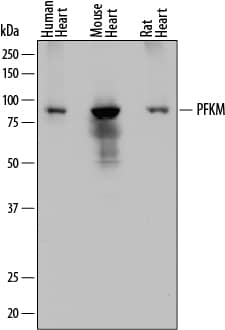 Western blot shows lysates of human heart tissue, mouse heart tissue, and rat heart tissue. PVDF membrane was probed with 0.2 µg/mL of Mouse Anti-Human Muscle Phospho-fructokinase/PFKM Monoclonal Antibody (Catalog # MAB7687) followed by HRP-conjugated Anti-Mouse IgG Secondary Antibody (Catalog # HAF018). A specific band was detected for Muscle Phosphofructokinase/PFKM at approximately 85 kDa (as indicated). This experiment was conducted under reducing conditions and using Immunoblot Buffer Group 1.
