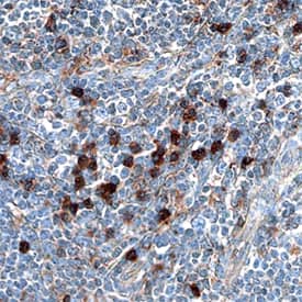 MxA/Mx1 was detected in immersion fixed paraffin-embedded sections of human thymus using Goat Anti-Human MxA/Mx1 Antigen Affinity-purified Polyclonal Antibody (Catalog # AF7946) at 3 µg/mL overnight at 4 °C. Before incubation with the primary antibody, tissue was subjected to heat-induced epitope retrieval using Antigen Retrieval Reagent-Basic (Catalog # CTS013). Tissue was stained using the Anti-Goat HRP-DAB Cell & Tissue Staining Kit (brown; Catalog # CTS008) and counterstained with hematoxylin (blue). Specific staining was localized to cytoplasm of thymocytes. View our protocol for Chromogenic IHC Staining of Paraffin-embedded Tissue Sections.