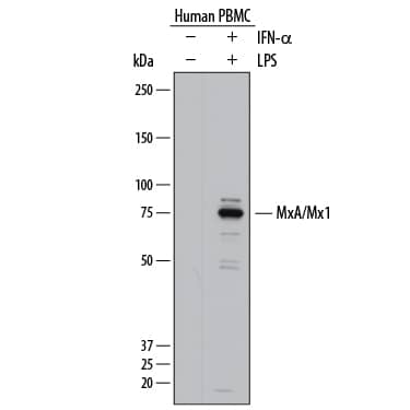 Western blot shows lysates of human peripheral blood mononuclear cells (PBMC) untreated (-) or treated (+) overnight with 20 µg/mL Recombinant Human IFN-a Universal Type I (Catalog # 11200-1) and 1 µg/mL LPS. PVDF membrane was probed with 1 µg/mL of Goat Anti-Human MxA/Mx1 Antigen Affinity-purified Polyclonal Antibody (Catalog # AF7946) followed by HRP-conjugated Anti-Goat IgG Secondary Antibody (Catalog # HAF017). A specific band was detected for MxA/Mx1 at approximately 75 kDa (as indicated). This experiment was conducted under reducing conditions and using Immunoblot Buffer Group 1.