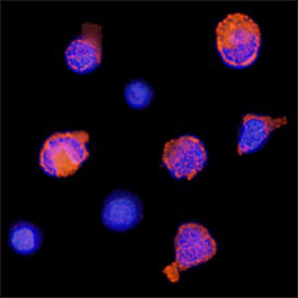 MxA/Mx1 was detected in immersion fixed human peripheral blood mononuclear cells (PBMCs) treated with IFN-alpha using Goat Anti-Human MxA/Mx1 Antigen Affinity-purified Polyclonal Antibody (Catalog # AF7946) at 1.7 µg/mL for 3 hours at room temperature. Cells were stained using the NorthernLights™ 557-conjugated Anti-Goat IgG Secondary Antibody (red; Catalog # NL001) and counterstained with DAPI (blue). Specific staining was localized to cytoplasm. View our protocol for Fluorescent ICC Staining of Non-adherent Cells.