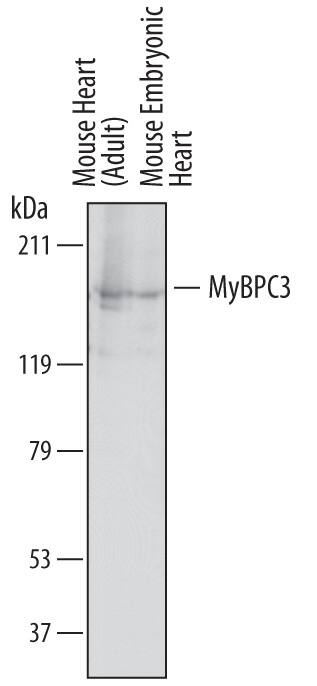 Western blot shows lysates of mouse heart tissue (adult) and mouse embryonic heart tissue. PVDF membrane was probed with 1 µg/mL of Sheep Anti-Mouse MyBPC3 Antigen Affinity-purified Polyclonal Antibody (Catalog # AF7199) followed by HRP-conjugated Anti-Sheep IgG Secondary Antibody (Catalog # HAF016). A specific band was detected for MyBPC3 at approximately 150 kDa (as indicated). This experiment was conducted under reducing conditions and using Immunoblot Buffer Group 1.