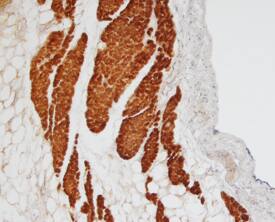 MyBPC3 was detected in immersion fixed paraffin-embedded sections of human heart using Sheep Anti-Human MyBPC3 Antigen Affinity-purified Polyclonal Antibody (Catalog # AF7439) at 15 µg/mL overnight at 4 °C. Tissue was stained using the Anti-Sheep HRP-DAB Cell & Tissue Staining Kit (brown; Catalog # CTS019) and counterstained with hematoxylin (blue). Specific staining was localized to cytoplasm of muscle cells. View our protocol for Chromogenic IHC Staining of Paraffin-embedded Tissue Sections.