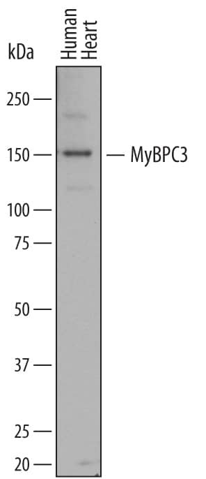 Western blot shows lysates of human heart tissue. PVDF membrane was probed with 1 µg/mL of Sheep Anti-Human MyBPC3 Antigen Affinity-purified Polyclonal Antibody (Catalog # AF7439) followed by HRP-conjugated Anti-Sheep IgG Secondary Antibody (Catalog # HAF016). A specific band was detected for MyBPC3 at approximately 150 kDa (as indicated). This experiment was conducted under reducing conditions and using Immunoblot Buffer Group 8.