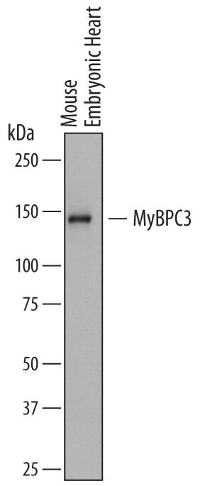 Western blot shows lysates of mouse embryonic heart tissue. PVDF membrane was probed with 2 µg/mL of Rat Anti-Mouse MyBPC3 Monoclonal Antibody (Catalog # MAB7199) followed by HRP-conjugated Anti-Rat IgG Secondary Antibody (Catalog # HAF005). A specific band was detected for MyBPC3 at approximately 140 kDa (as indicated). This experiment was conducted under reducing conditions and using Immunoblot Buffer Group 1.