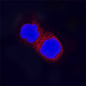 MyD88 was detected in immersion fixed Raji human Burkitt's lymphoma cell line using Goat Anti-Human MyD88 Antigen Affinity-purified Polyclonal Antibody (Catalog # AF2928) at 15 µg/mL for 3 hours at room temperature. Cells were stained using the NorthernLights™ 557-conjugated Anti-Goat IgG Secondary Antibody (red; Catalog # NL001) and counterstained with DAPI (blue). Specific staining was localized to cytoplasm. View our protocol for Fluorescent ICC Staining of Non-adherent Cells.