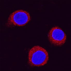 MyD88 was detected in immersion fixed RAW 264.7 mouse monocyte/macrophage cell line using Goat Anti-Mouse/Rat MyD88 Antigen Affinity-purified Polyclonal Antibody (Catalog # AF3109) at 1.7 µg/mL for 3 hours at room temperature. Cells were stained using the NorthernLights™ 557-conjugated Anti-Goat IgG Secondary Antibody (red; Catalog # NL001) and counterstained with DAPI(blue). Specific staining was localized to cytoplasmic. View our protocol for Fluorescent ICC Staining of Cells on Coverslips.