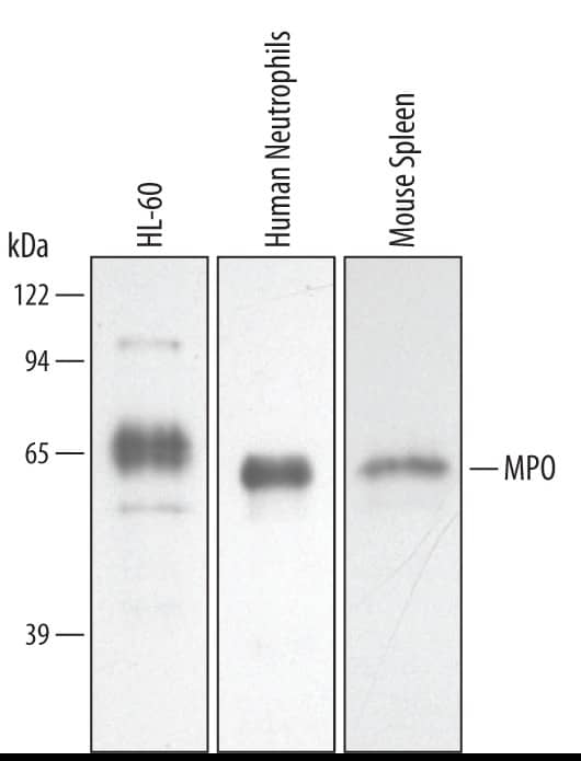 Western blot shows lysates of HL-60 human acute promyelocytic leukemia cell line, human neutrophil cells, and mouse spleen tissue. PVDF membrane was probed with 0.5 µg/mL of Goat Anti-Human/Mouse Myeloperoxidase/MPO Antigen Affinity-purified Polyclonal Antibody (Catalog # AF3667) followed by HRP-conjugated Anti-Goat IgG Secondary Antibody (HAF019). A specific band was detected for Myeloperoxidase/MPO at approximately 60 kDa (as indicated). This experiment was conducted under reducing conditions and using Immunoblot Buffer Group 2.