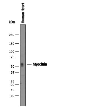 Western blot shows lysates of human heart tissue. PVDF membrane was probed with 1 µg/mL of Goat Anti-Human Myocilin Antigen Affinity-purified Polyclonal Antibody (Catalog # AF2537) followed by HRP-conjugated Anti-Goat IgG Secondary Antibody (Catalog # HAF019). Specific bands were detected for Myocilin at approximately 55 and 60 kDa (as indicated). This experiment was conducted under reducing conditions and using Immunoblot Buffer Group 1.
