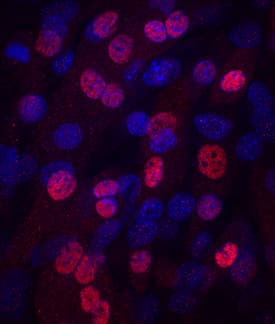 Immunocytochemistry Myogenin Antibody (671037)