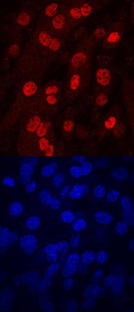 Myogenin was detected in immersion fixed differentiated C2C12 mouse myoblast cells using Mouse Anti-Human Myogenin Monoclonal Antibody (Catalog # MAB6686) at 10 µg/mL for 3 hours at room temperature. Cells were stained using the NorthernLights™ 557-conjugated Anti-Mouse IgG Secondary Antibody (red, upper panel; NL007) and counterstained with DAPI (blue, lower panel). Specific staining was localized to select differentiating nuclei. View our protocol for Fluorescent ICC Staining of Cells on Coverslips.