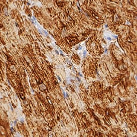 Immunohistochemistry Myoglobin Antibody (974140) [Unconjugated]