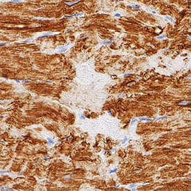 Myoglobin was detected in immersion fixed paraffin-embedded sections of human heart using Mouse Anti-Human Myoglobin Monoclonal Antibody (Catalog # MAB97202) at 1.7 µg/mL for 1 hour at room temperature followed by incubation with the Anti-Mouse IgG VisUCyte™ HRP Polymer Antibody (Catalog # VC001). Tissue was stained using DAB (brown) and counterstained with hematoxylin (blue). Specific staining was localized to sarcoplasm. View our protocol for IHC Staining with VisUCyte HRP Polymer Detection Reagents.